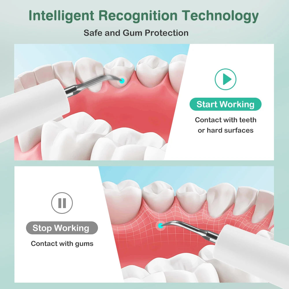 Ultrasonic Dental Scaler Teeth Tartar Remover Electric Plaque Cleaner for Home Oral Hygiene