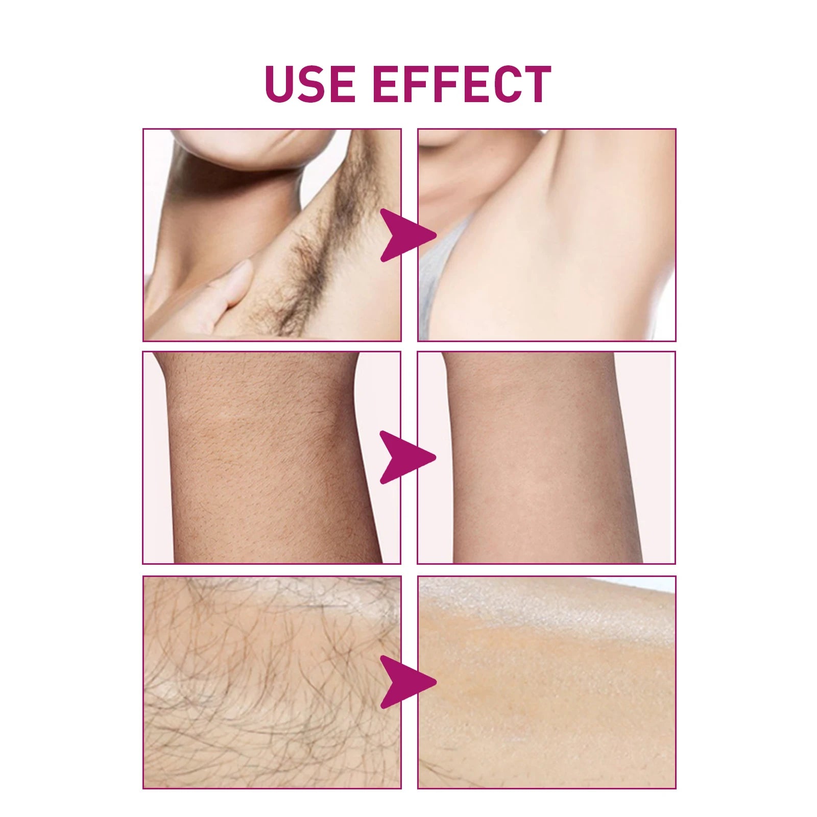 Hair Removal Cream Painless Depilatory Lotion for Smooth Skin Body Grooming - 4
