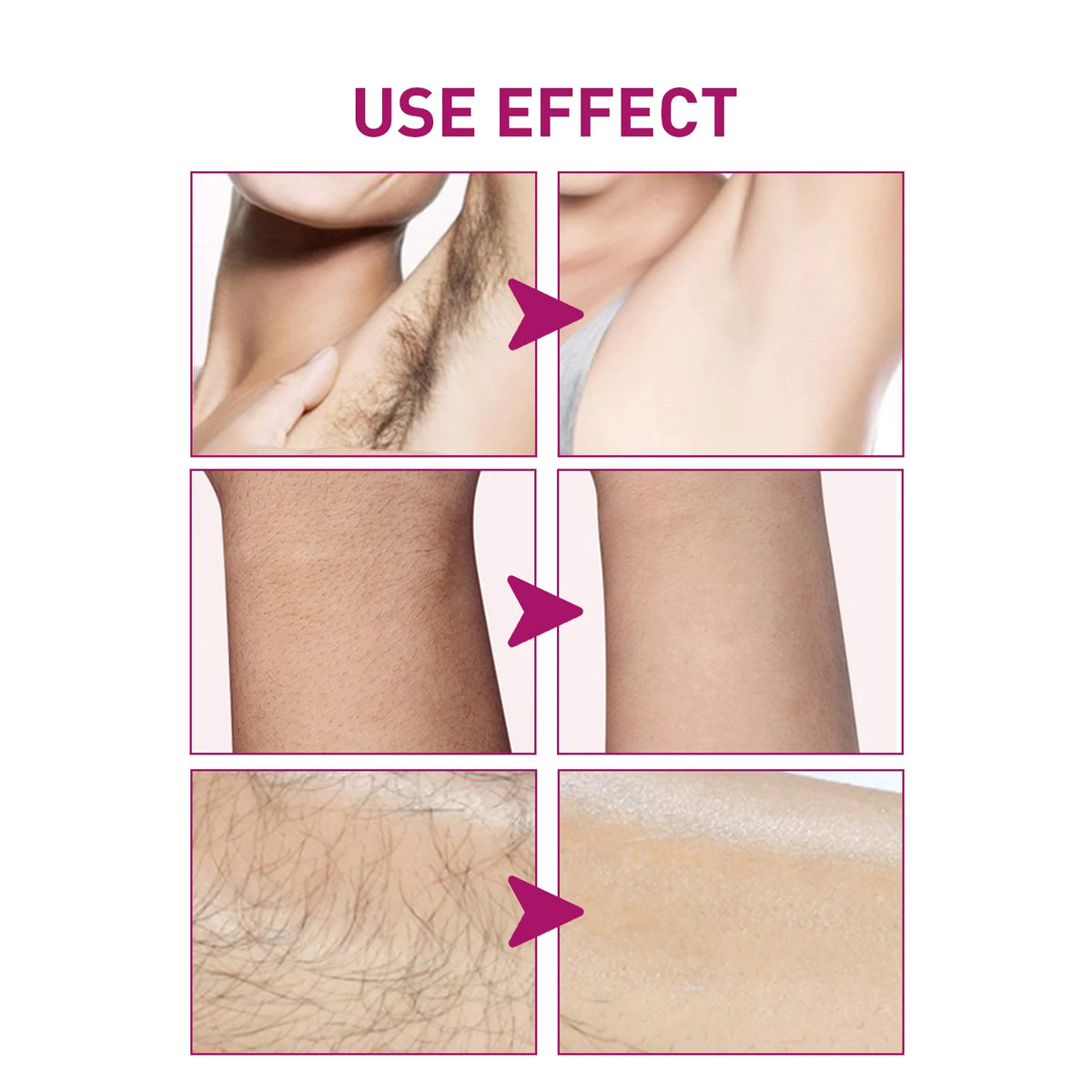 Hair Removal Cream Painless Depilatory Lotion for Smooth Skin Body Grooming