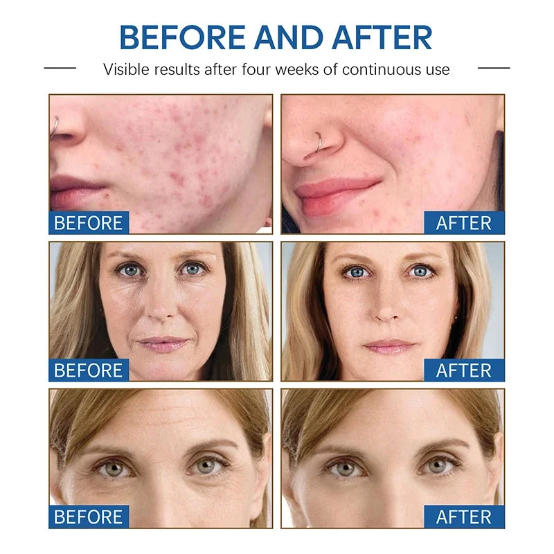Anti Wrinkle Face Cream Moisturizing Anti Aging Serum for Firming Skin - 3
