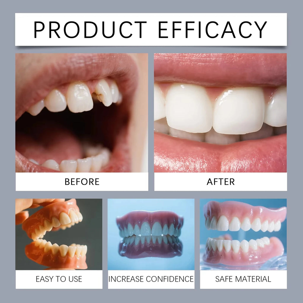 Silicone Dentures Full Set Artificial Teeth Natural Comfort Fit for Adult Oral Beauty Daily Use