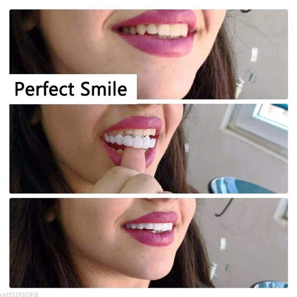 Veneer Snap on Teeth Kit Temporary Tooth Replacement Cosmetic Cover for Smile