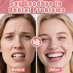 Full Denture Set Realistic Temporary False Teeth for Natural Comfortable Smile