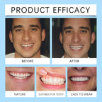 Full Denture Set Silicone False Teeth Cosmetic Veneers for Smile Improvement