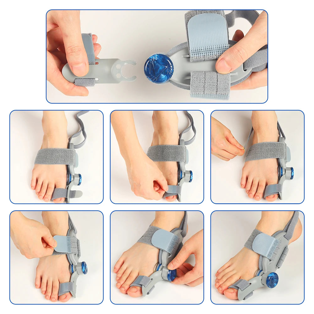 Bunion Adjuster Brace Big Toe Straightener with Knob Dial for Pain Relief and Natural Alignment - 17