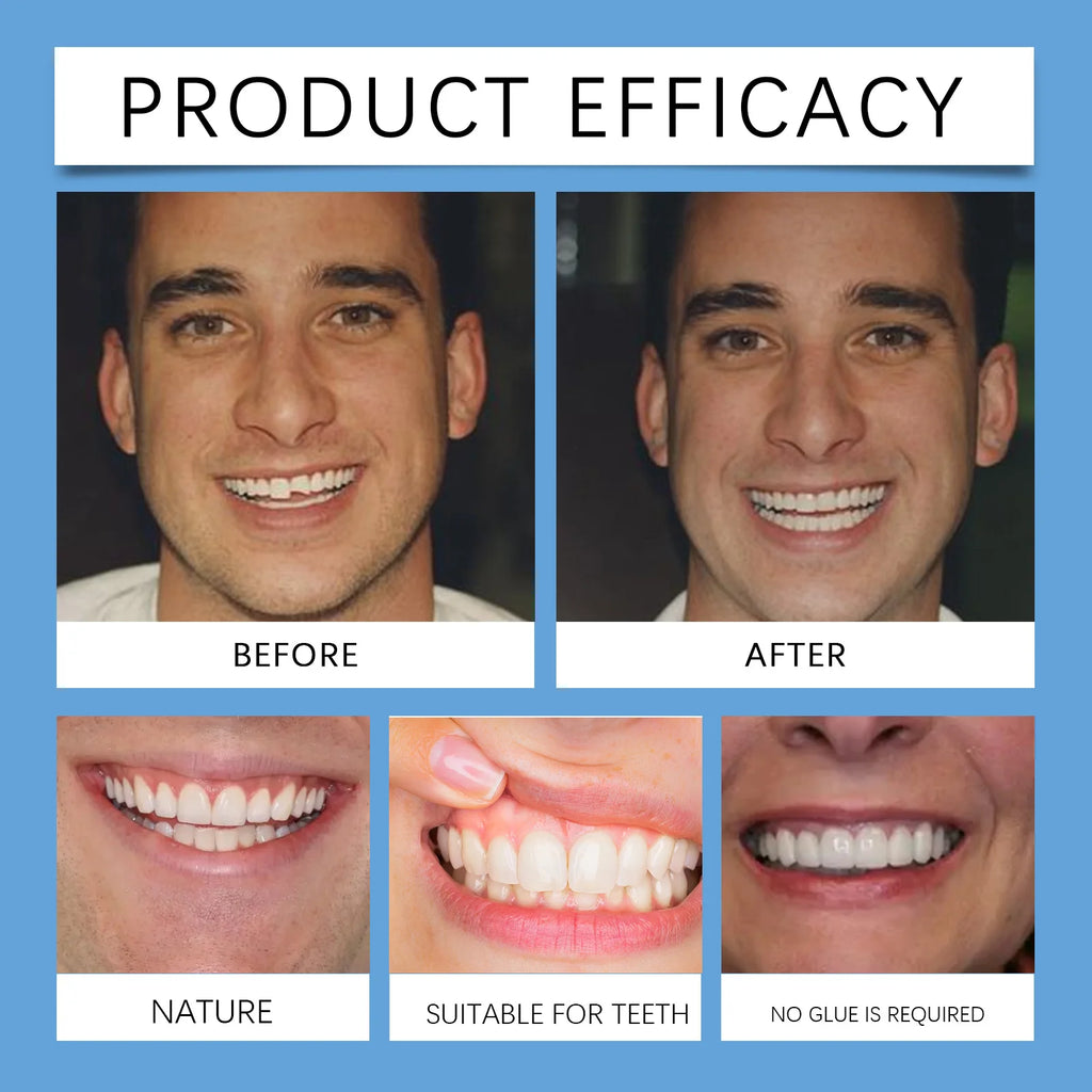 Adjustable Snap On Dentures False Teeth Cosmetic Veneers for Smile Correction
