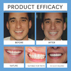 Adjustable Snap On Dentures False Teeth Cosmetic Veneers for Smile Correction