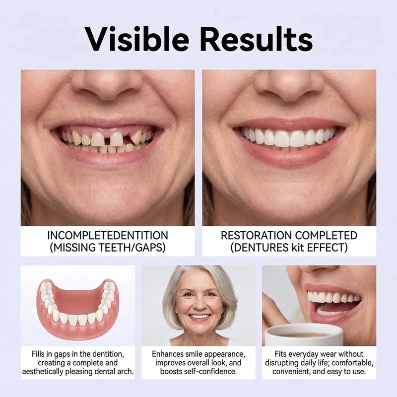 Full Set Silicone Dentures Natural False Teeth Soft Comfort Fit for Instant Smile Enhancement