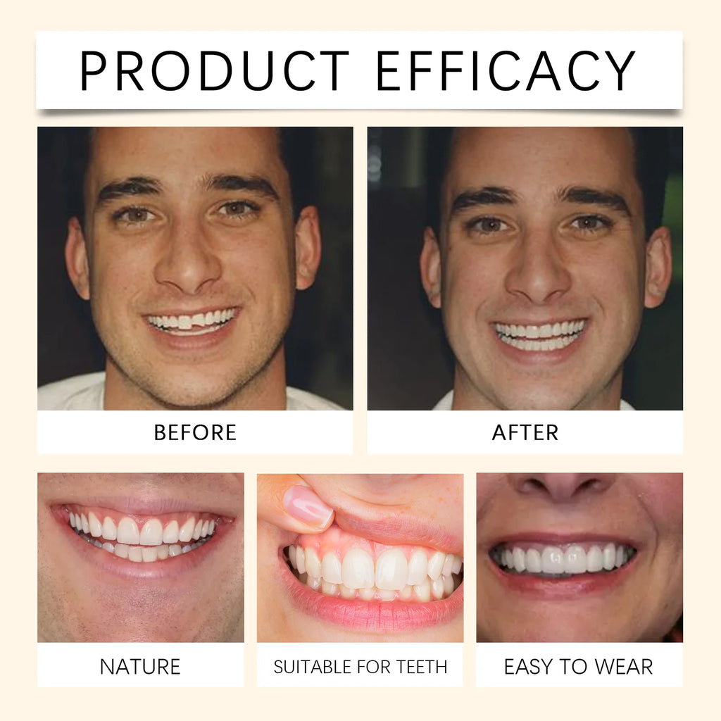 Silicone False Teeth Dentures Temporary Veneers for Missing Broken Teeth