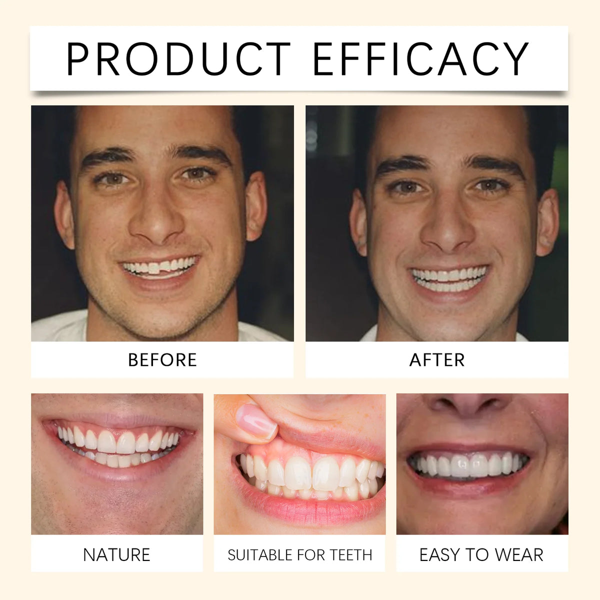 Silicone False Teeth Dentures Temporary Veneers for Missing Broken Teeth