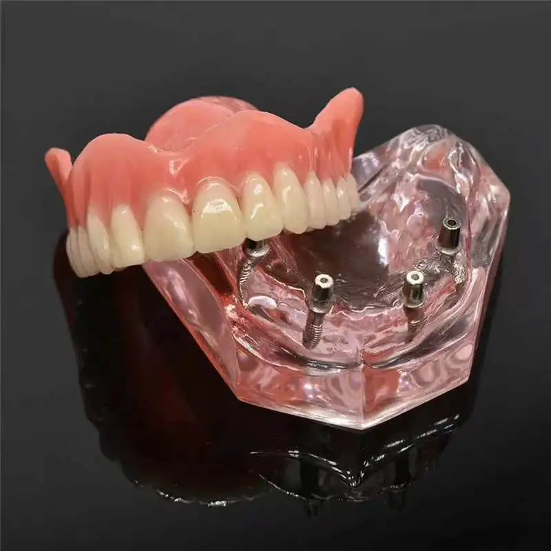 Cosmetic Dental Veneers Snap On Smile Teeth Covers for Daily Confidence and Perfect Natural Look