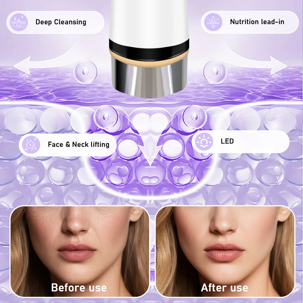 Microcurrent Facial Massager Face Lifting Device LED Skin Tightening Tool for Home Beauty Care