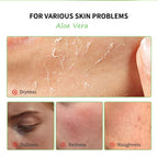 Aloe Vera Gel Moisturizing Facial Cream Soothing Skin Hydration for Daily Face Care Routine
