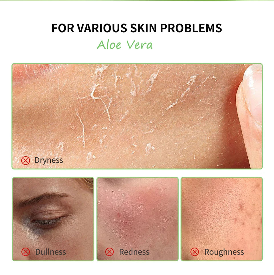 Aloe Vera Gel Moisturizing Facial Cream Soothing Skin Hydration for Daily Face Care Routine