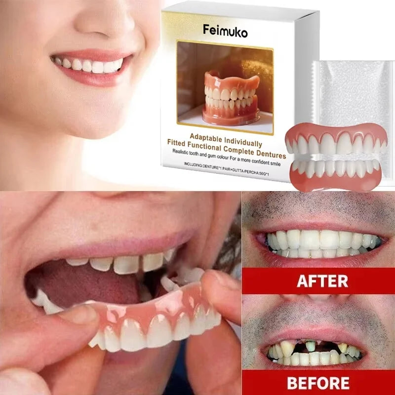 Denture Decoration Set Fake Teeth Veneers Resin Kit for Confident Smile - 2