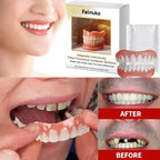 Denture Decoration Set Fake Teeth Veneers Resin Kit for Confident Smile