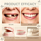 Soft Silicone Dentures False Teeth Cosmetic Veneers for Natural Looking Bright Smile