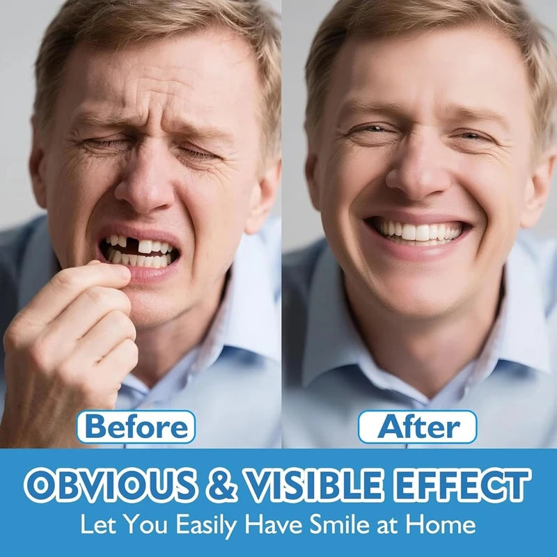 Natural Dentures Set Cosmetic Fake Teeth Smile Trainer Comfort Fit for Men and Women Daily Use