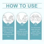 Aligner and Retainer Cleaner Foam Mousse Whitening Agent for Daily Dental Appliance Care
