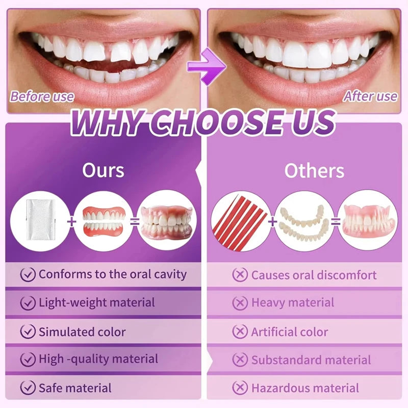 Full Set Silicone Dentures Natural False Teeth Soft Comfort Fit for Instant Smile Enhancement